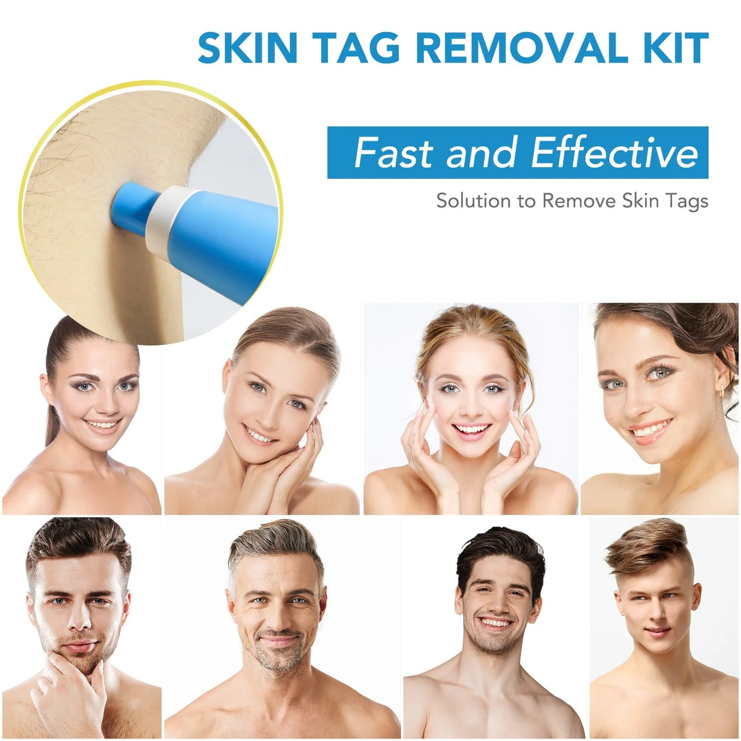 Skin Tag Remover Kit