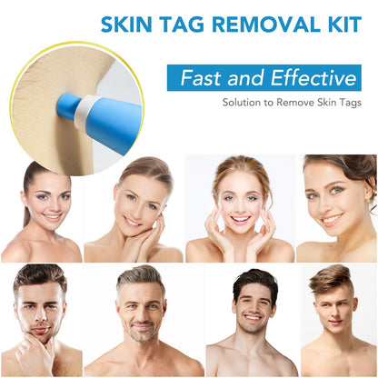 Skin Tag Remover Kit